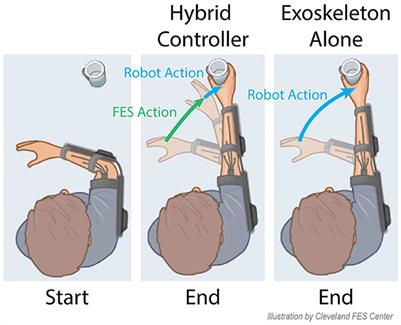 Hybrid FES-exoskeleton control: Using MPC to distribute actuation for elbow and wrist movements